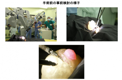 弾性臓器立体模型による ロボット手術
