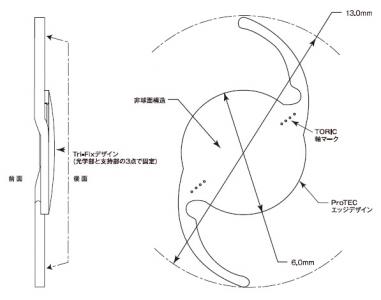 角膜乱視