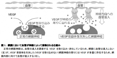 血管が排除される仕組み