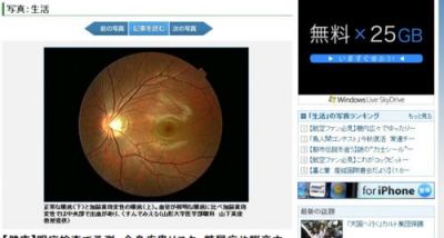 眼底検査