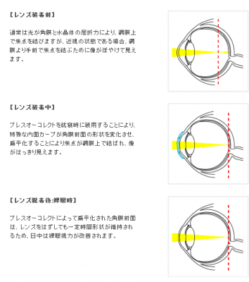 ブレスオーコレクト